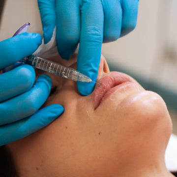 Esecuzione trattamento Filler Labbra allo studio Aleri Medicina Estetica di Milano